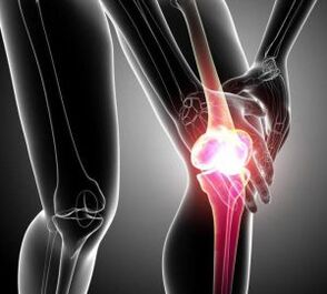 dolore al ginocchio nell'artrite e nell'artrosi
