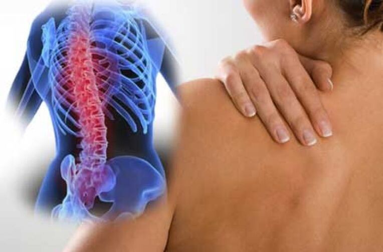 Durante un'esacerbazione dell'osteocondrosi della colonna vertebrale toracica, si verifica dolore dorsago