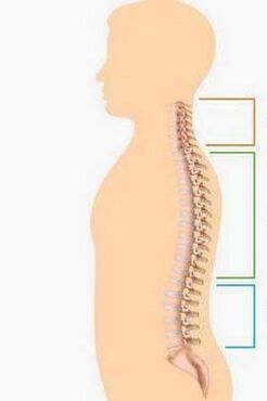 lesione di osteocondosi di diverse parti della colonna vertebrale